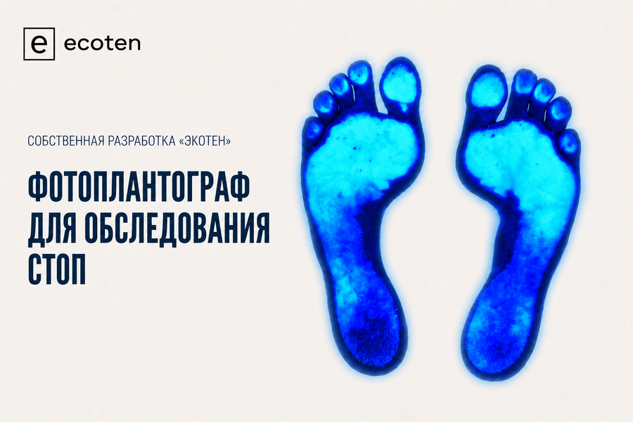 «Экотен» получил патент на фотоплантограф для обследования стоп